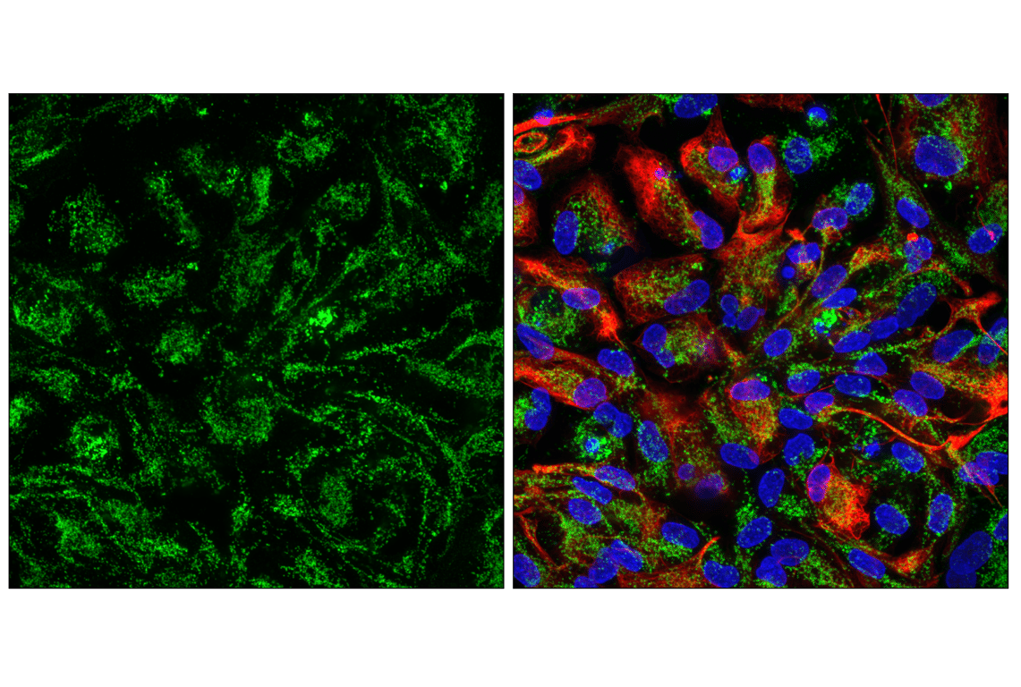 Immunofluorescence Image 3: COX IV (3E11) Rabbit mAb