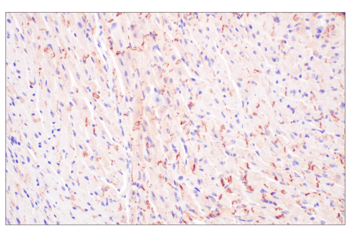 Immunohistochemistry Image 6: Desmoplakin (F3J8Y) Rabbit Monoclonal Antibody