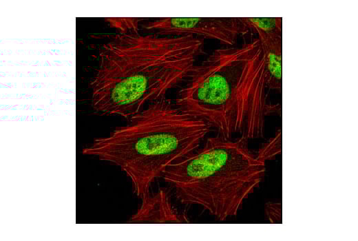 Immunofluorescence Image 1: RAD21 (D213) Antibody