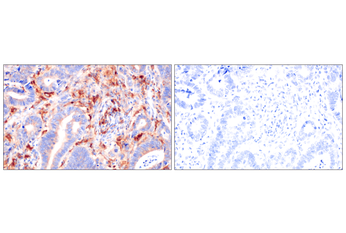 Cathepsin Z (F4M4S) Rabbit Monoclonal Antibody | Cell Signaling