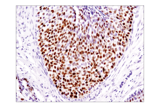 Immunohistochemistry Image 1: Progesterone Receptor A/B (D8Q2J) Rabbit Monoclonal Antibody (BSA and Azide Free)