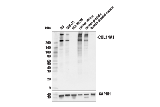 Western Blotting Image 2: COL14A1 (E5W8S) Rabbit Monoclonal Antibody