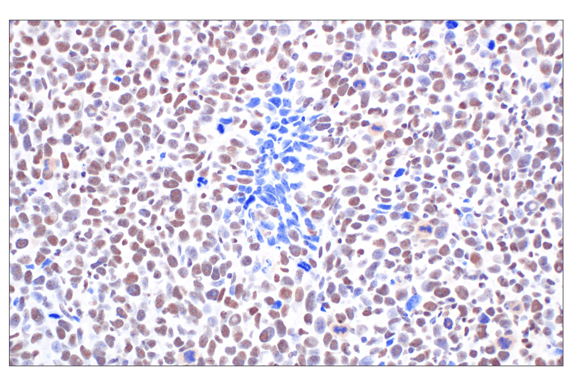 undefined Image 31: PPAR gamma Regulated Fatty Acid Metabolism Antibody Sampler Kit