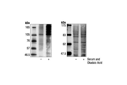 Western Blotting Image 2: Phospho-Threonine-Proline Mouse Monoclonal Antibody (P-Thr-Pro-101)
