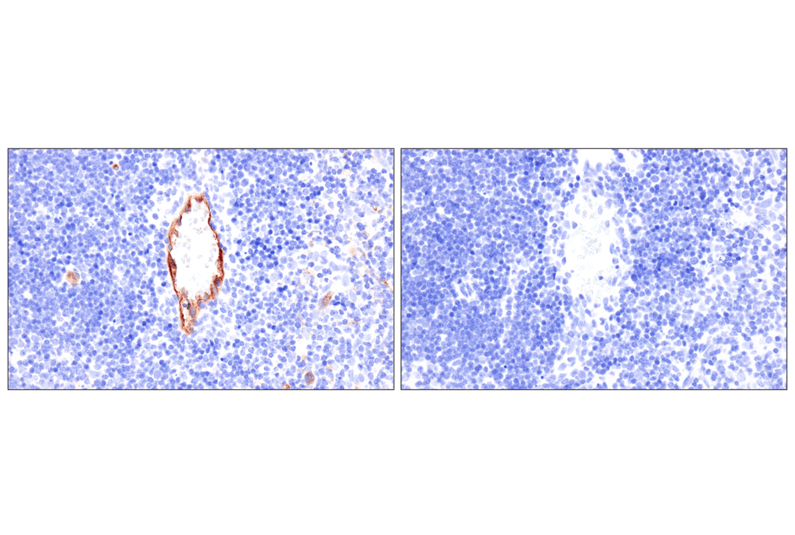 Immunohistochemistry Image 6: ESAM (F9D9P) Rabbit Monoclonal Antibody