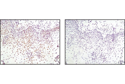 Immunohistochemistry Image 3: FoxP1 Antibody