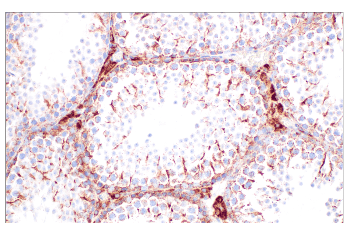 undefined Image 43: Organelle Localization IF Antibody Sampler Kit