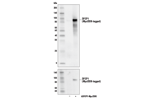 Western Blotting Image 2: DFCP1 (E9R6P) Rabbit Monoclonal Antibody
