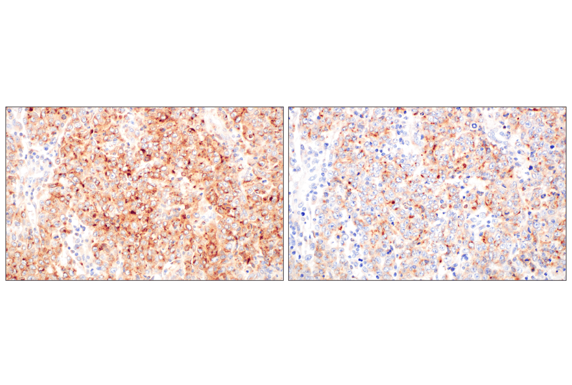 Immunohistochemistry Image 9: LY6E (F8Y1R) Rabbit Monoclonal Antibody