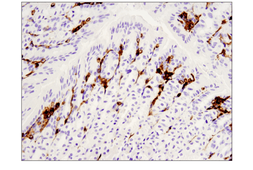 CD45 (D3F8Q) Rabbit mAb | Cell Signaling Technology