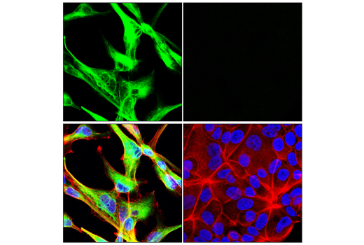 Immunofluorescence Image 1: Nestin (E4O9E) XP<sup>®</sup> Rabbit mAb