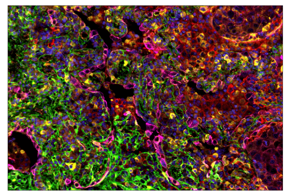 Immunohistochemistry Image 6: Phospho-S6 Ribosomal Protein (Ser235/236) (D57.2.2E) & CO-0107-488 SignalStar<sup>™</sup> Oligo-Antibody Pair