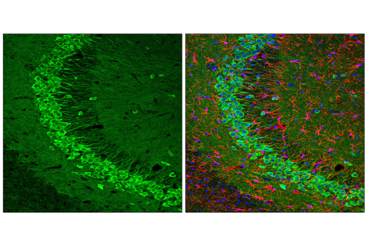 Immunofluorescence Image 1: UCHL1 (E6B8E) Mouse Monoclonal Antibody