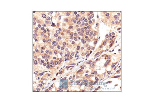 undefined Image 38: HSP/Chaperone Antibody Sampler Kit