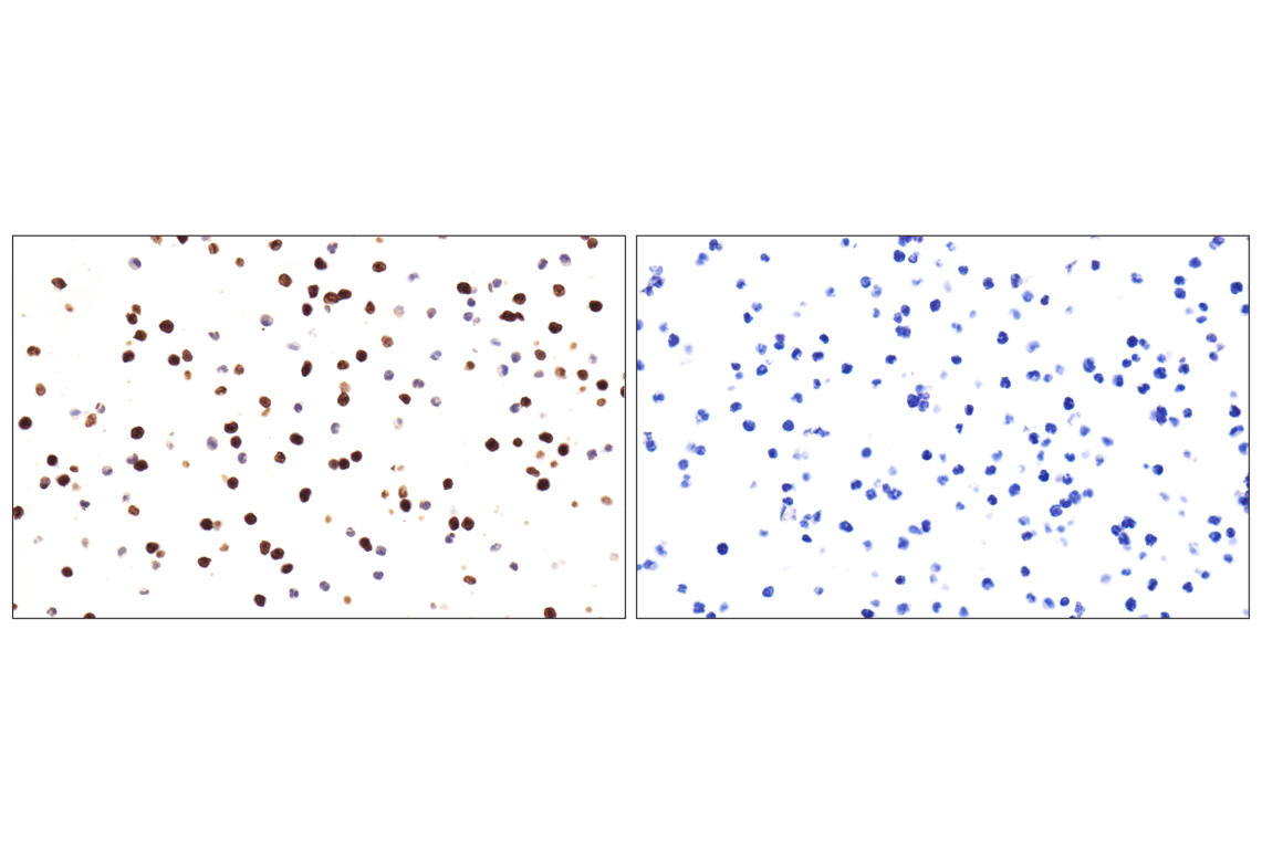 Immunohistochemistry Image 18: CD177 (F9O5U) Rabbit Monoclonal Antibody (BSA and Azide Free)