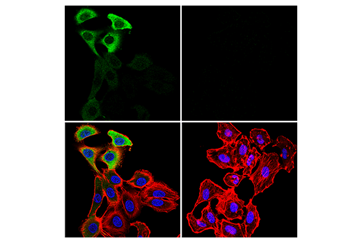 Immunofluorescence Image 2: SARS-CoV-2 Nucleocapsid Protein (HL344) Rabbit Monoclonal Antibody