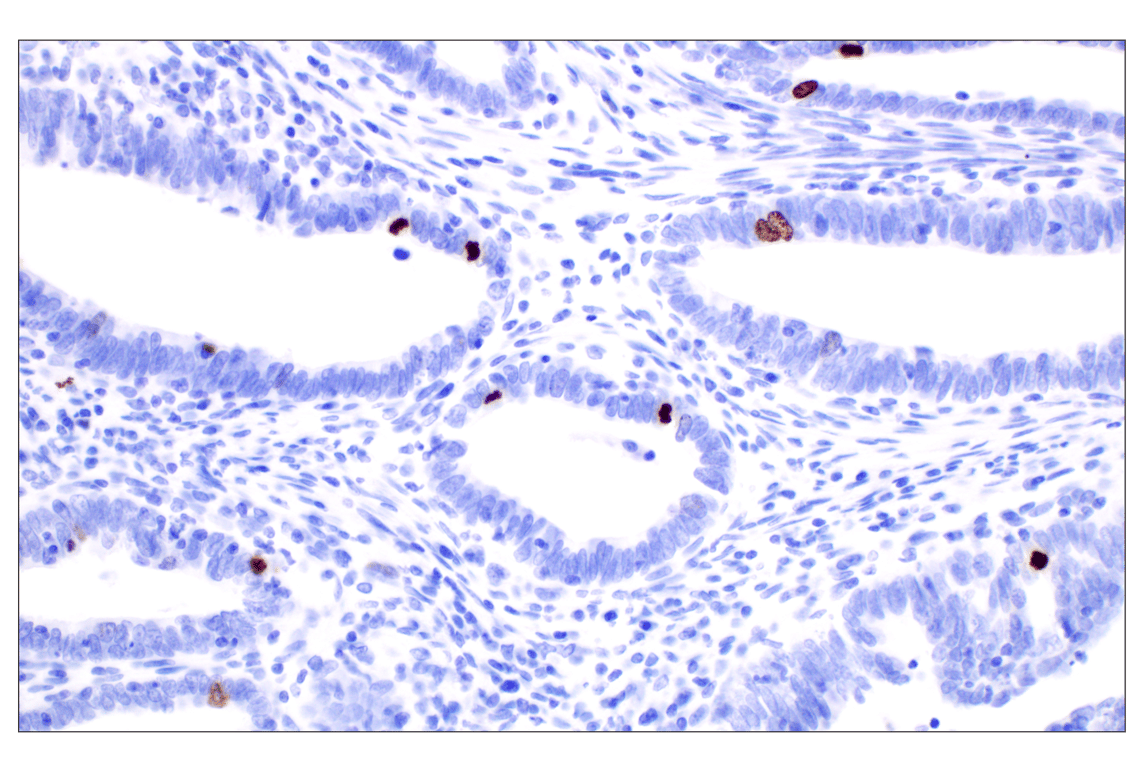 Immunohistochemistry Image 8: Phospho-Histone H3 (Ser10) (D7N8E) Rabbit Monoclonal Antibody