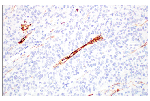 Immunohistochemistry Image 5: Nestin (E4O9E) Rabbit Monoclonal Antibody (BSA and Azide Free)