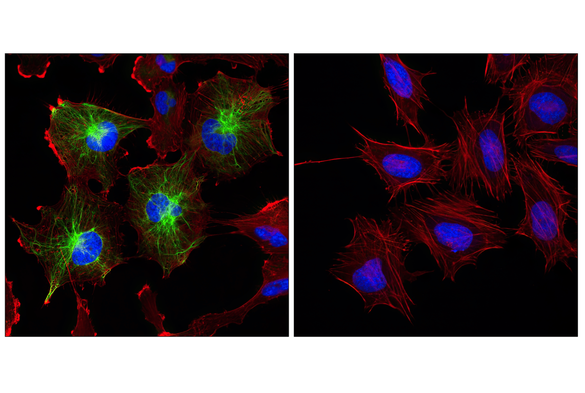 Immunofluorescence Image 1: GFAP (GA5) Mouse Monoclonal Antibody