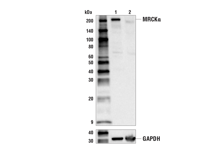 Western Blotting Image 2: MRCK alpha (E2S5I) Rabbit Monoclonal Antibody