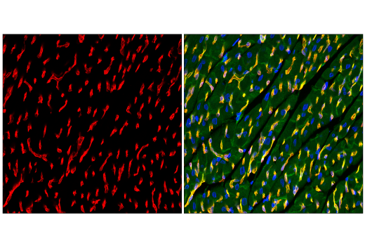 Immunofluorescence Image 2: Caveolin-1 (D46G3) XP<sup>®</sup> Rabbit mAb (Alexa Fluor<sup>®</sup> 647 Conjugate)