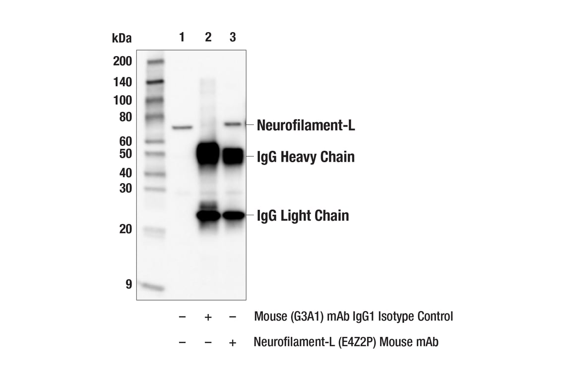 Immunoprecipitation Image 2: Neurofilament-L (E4Z2P) Mouse Monoclonal Antibody