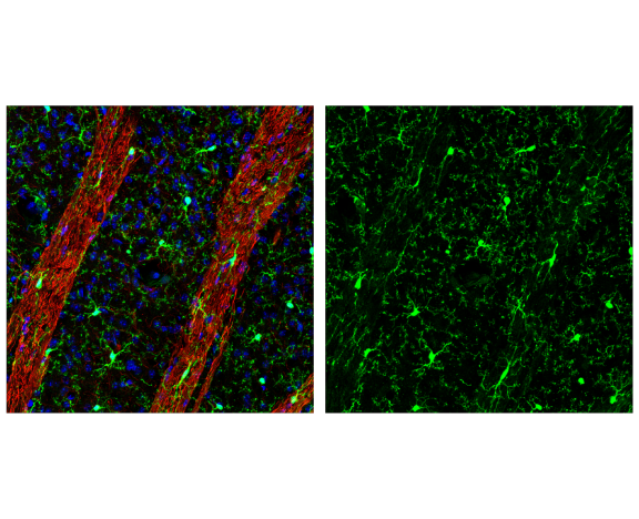 Immunofluorescence Image 1: CD45 (D3F8Q) Rabbit Monoclonal Antibody (BSA and Azide Free)