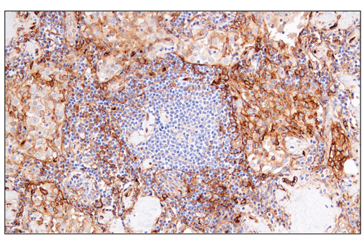 Immunohistochemistry Image 3: CD141/Thrombomodulin (E7Y9P) Rabbit Monoclonal Antibody