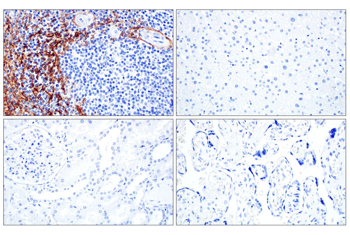 Immunohistochemistry Image 2: MAdCAM-1 (E1V8F) Rabbit Monoclonal Antibody (BSA and Azide Free)