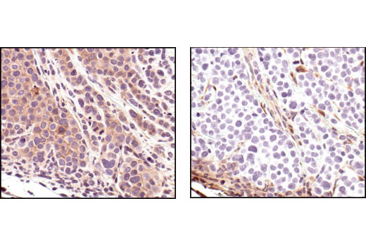 Immunohistochemistry Image 3: PTEN (138G6) Rabbit Monoclonal Antibody (BSA and Azide Free)