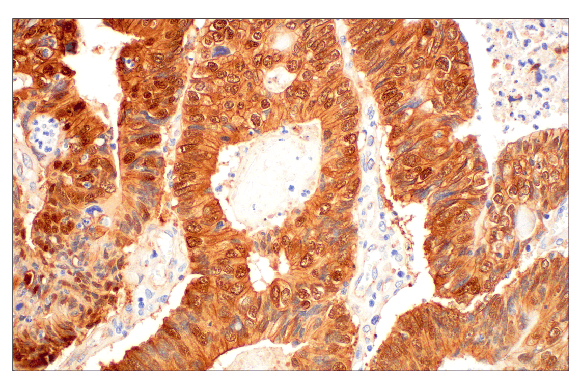 Immunohistochemistry Image 3: beta-Catenin (D10A8) Rabbit Monoclonal Antibody