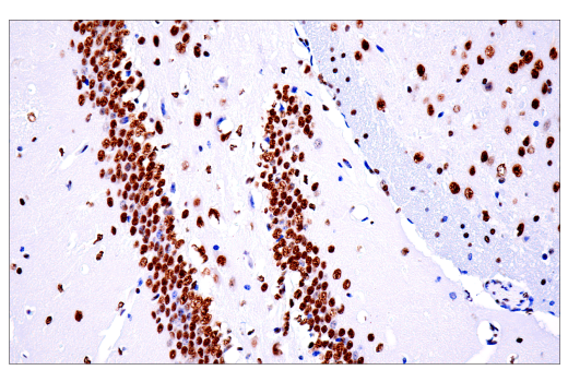 Immunohistochemistry Image 2: TDP43 (E2G6G) Rabbit Monoclonal Antibody (BSA and Azide Free)