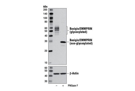 undefined Image 20: SARS-CoV-2 Virus-Host Interaction Antibody Sampler Kit