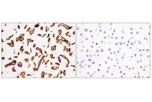 Immunohistochemistry Image 3: PVR/CD155 (D8A5G) Rabbit Monoclonal Antibody (BSA and Azide Free)