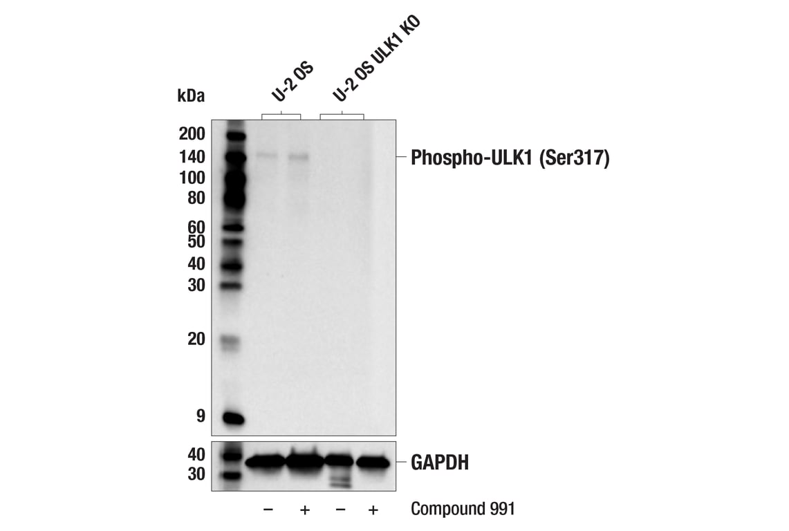 Western Blotting Image 3: Phospho-ULK1 (Ser317) (F1Z6C) Rabbit Monoclonal Antibody