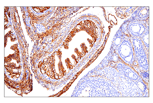 Immunohistochemistry Image 7: NCAM1 (CD56) (E7X9M) Rabbit Monoclonal Antibody (BSA and Azide Free)