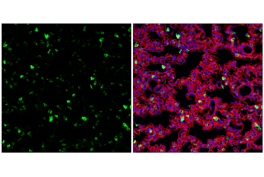 Immunofluorescence Image 2: Lysozyme C-1/2 (E2K5R) Rabbit Monoclonal Antibody