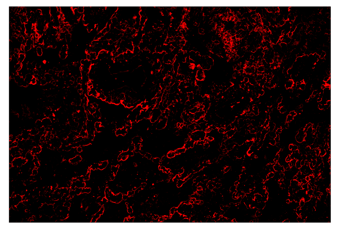 Immunohistochemistry Image 4: CD54/ICAM-1 (E3Q9N) & CO-0146-594 SignalStar<sup>™</sup> Oligo-Antibody Pair