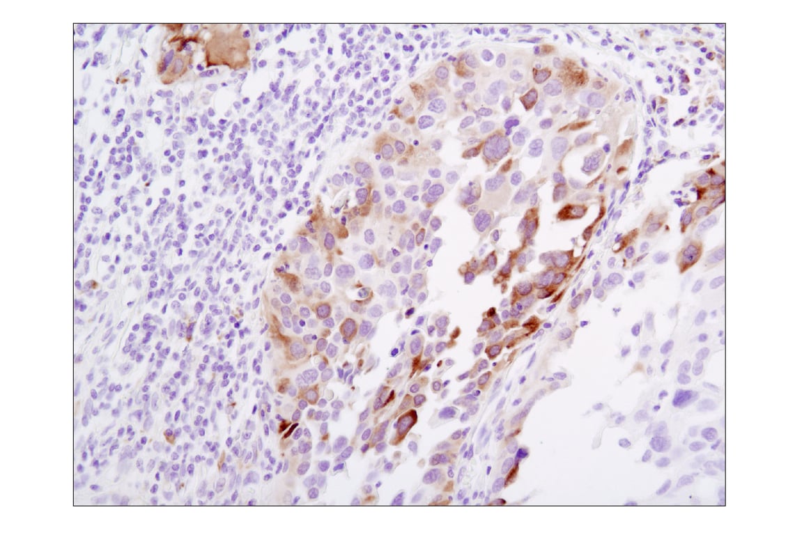 Immunohistochemistry Image 2: Phospho-S6 Ribosomal Protein (Ser235/236) (D57.2.2E) Rabbit Monoclonal Antibody (BSA and Azide Free)