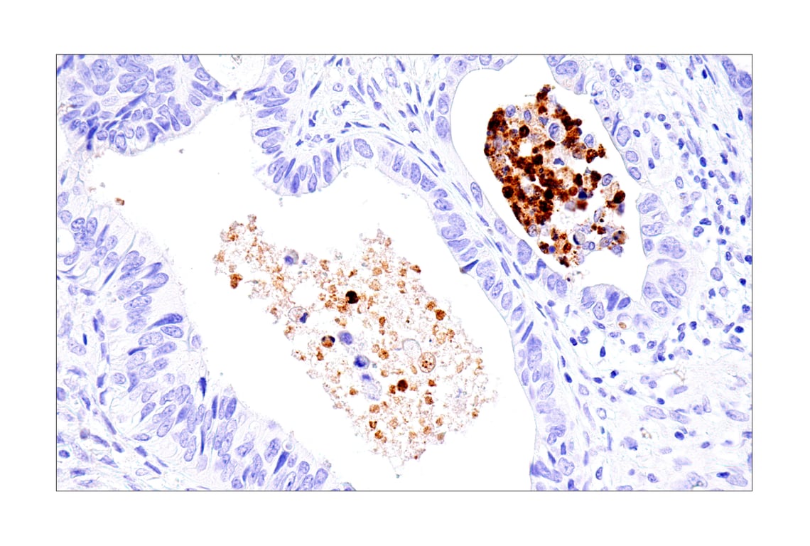 Immunohistochemistry Image 1: IL-8 (E5F5Q) Rabbit Monoclonal Antibody