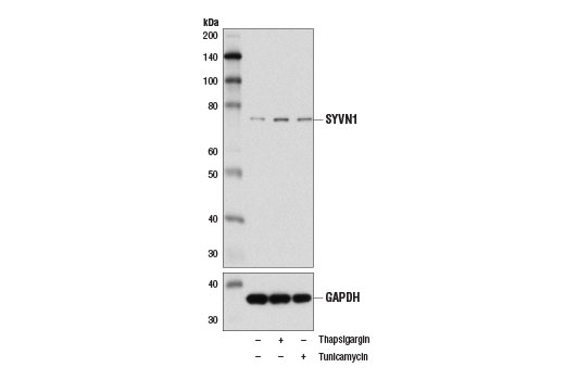Western Blotting Image 3: SYVN1 (D3O2A) Rabbit Monoclonal Antibody