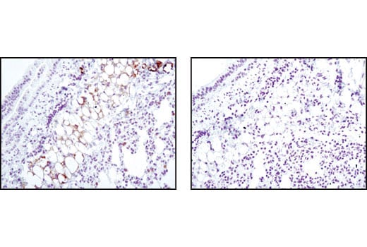 Immunohistochemistry Image 2: SCD1 (C12H5) Rabbit Monoclonal Antibody (BSA and Azide Free)