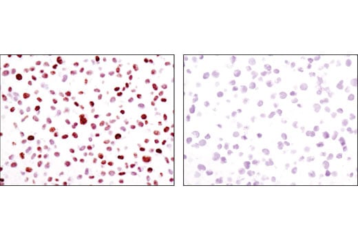 Immunohistochemistry Image 2: HMGA2 (D1A7) Rabbit Monoclonal Antibody