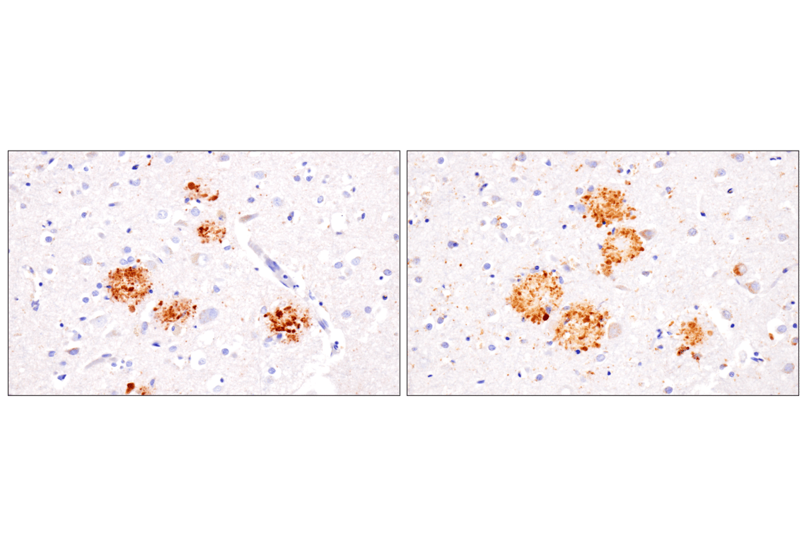 Immunohistochemistry Image 2: TMEM106B (E7H7Z) Rabbit Monoclonal Antibody
