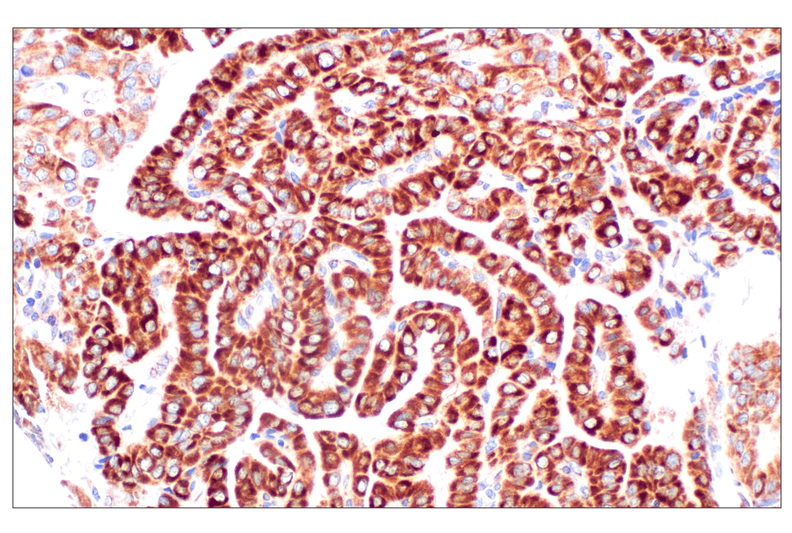 undefined Image 13: Organelle Localization IF Antibody Sampler Kit