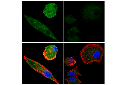 Immunofluorescence Image 2: Calpain 2 Large Subunit (M-type) (E3M6E) Rabbit Monoclonal Antibody (BSA and Azide Free)