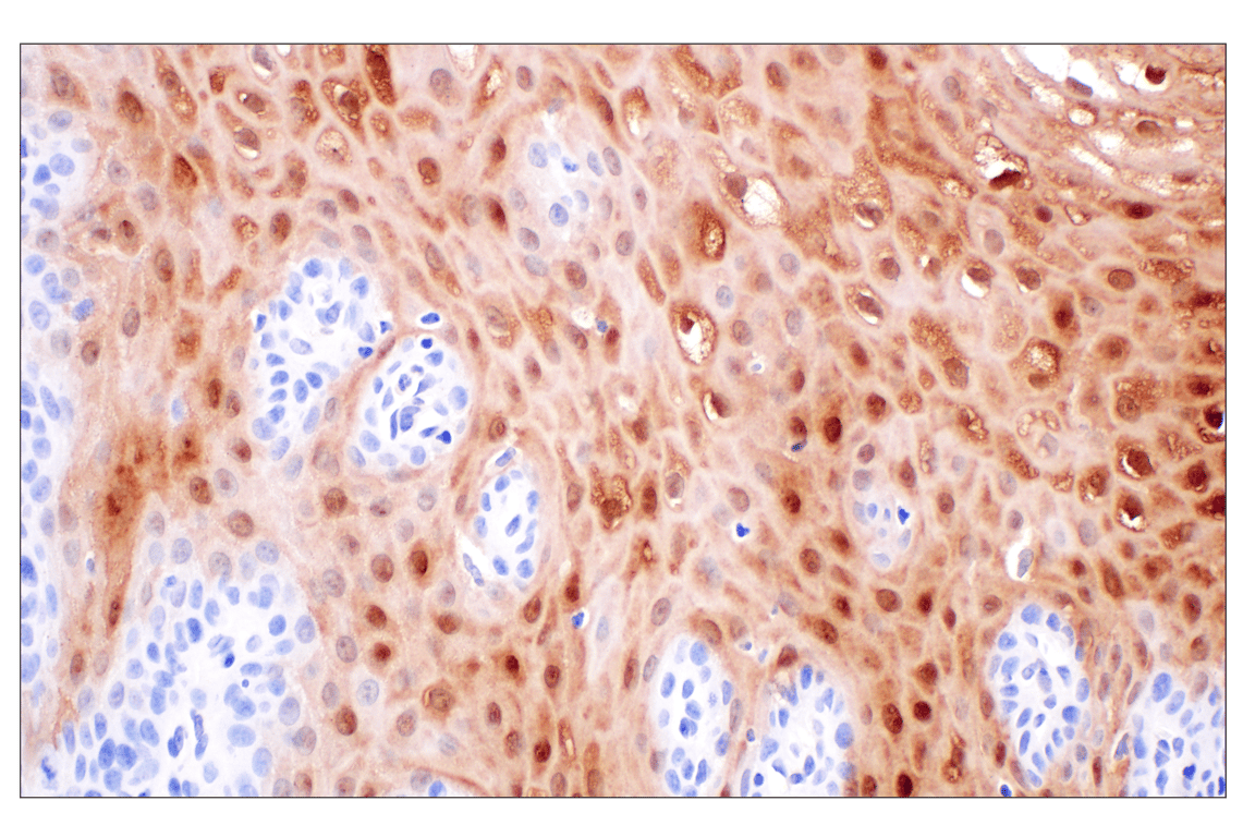 SERPINB3 (F3Z8E) Rabbit Monoclonal Antibody | Cell Signaling