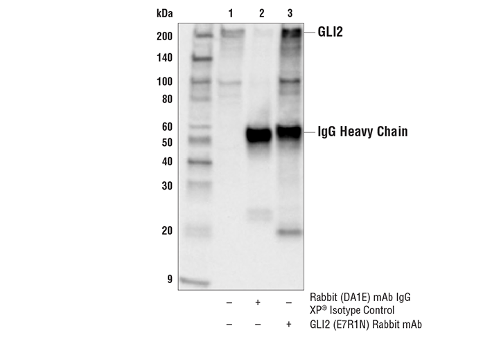 Immunoprecipitation Image 1: GLI2 (E7R1N) Rabbit Monoclonal Antibody