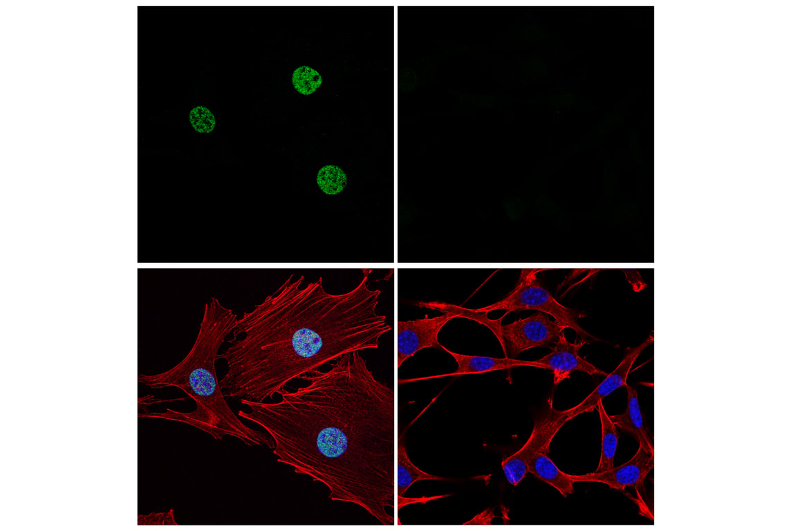 Immunofluorescence Image 1: p300 (E6D1T) Rabbit mAb (BSA and Azide Free)