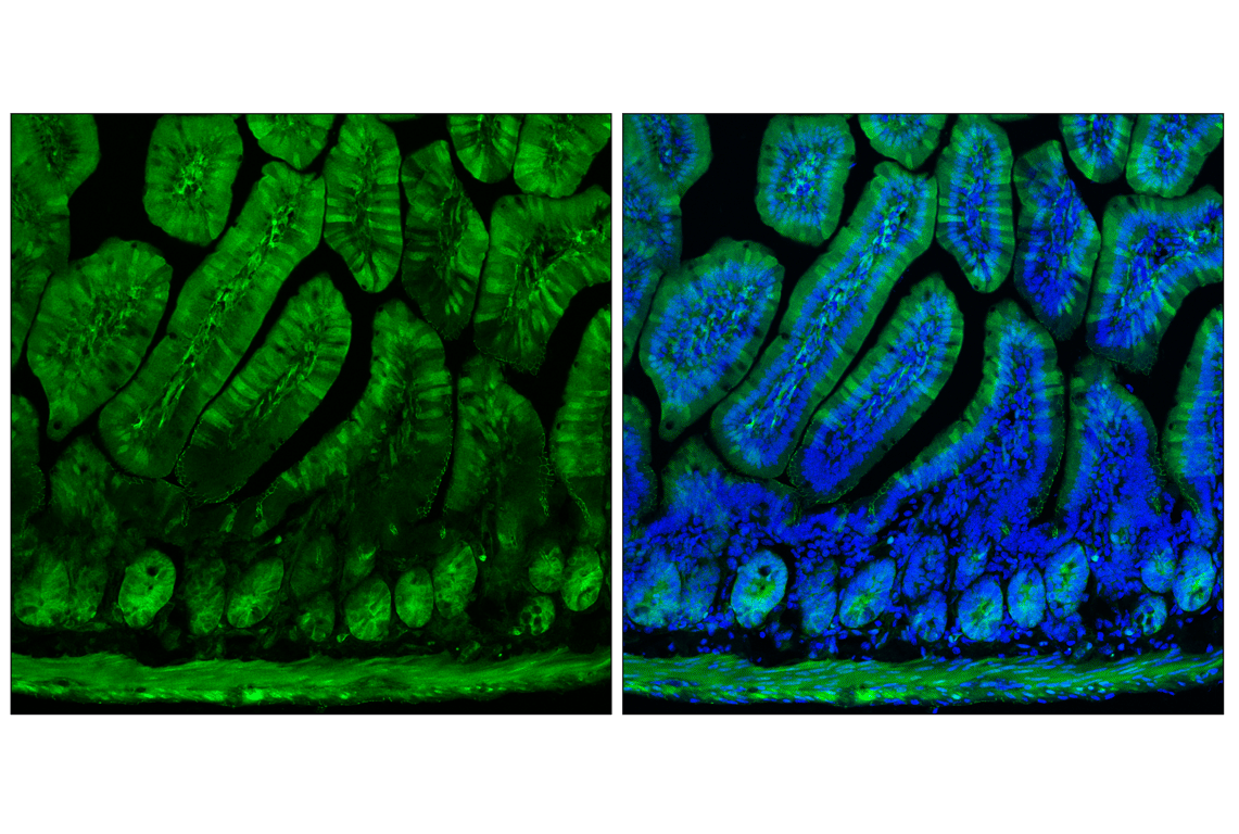 Immunofluorescence Image 1: YAP (D8H1X) XP<sup>®</sup> Rabbit mAb